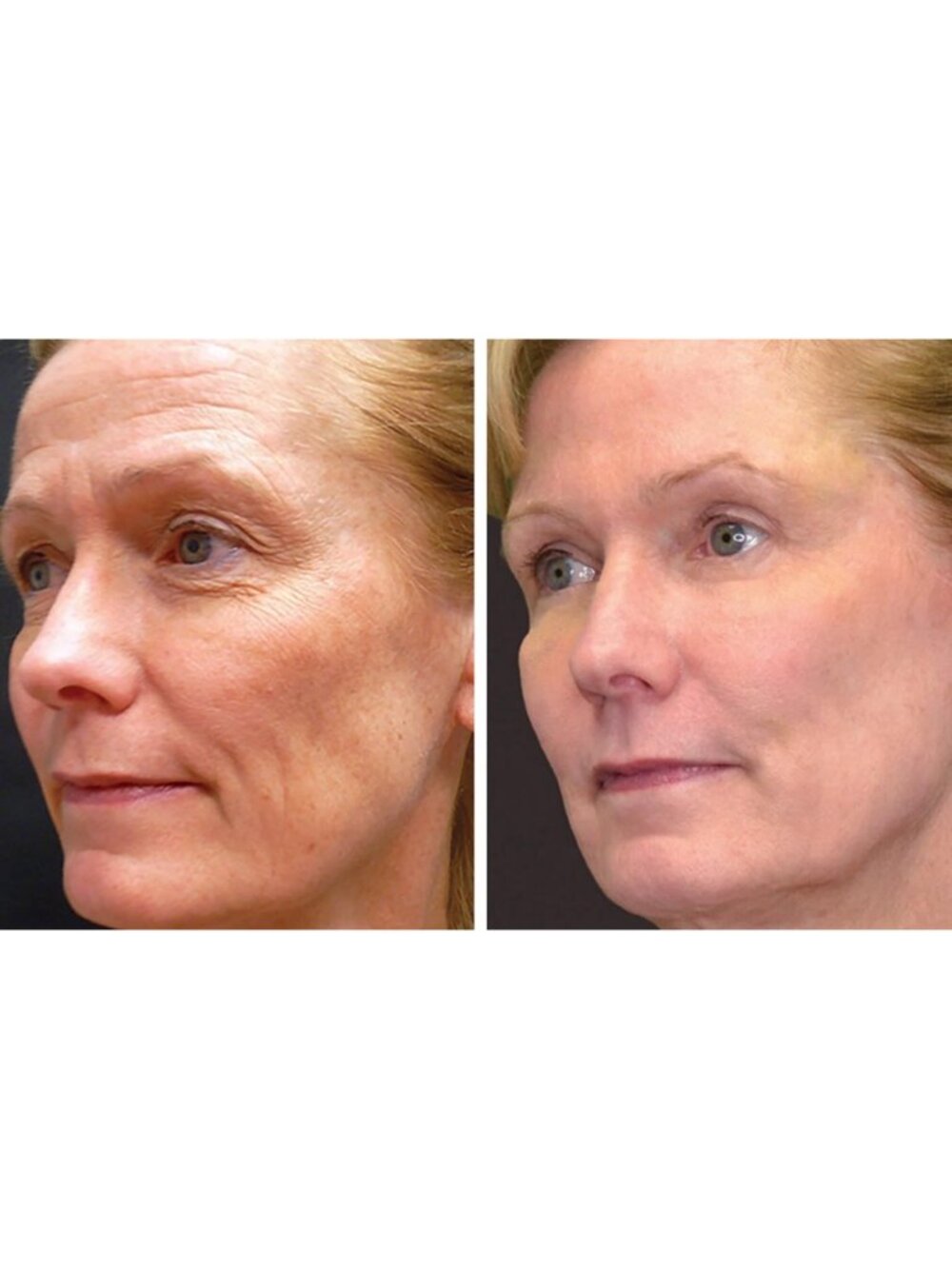Secret Collagen Timeless Age Defying Ritual Collection 6PCs Set - Picture 3 of 7